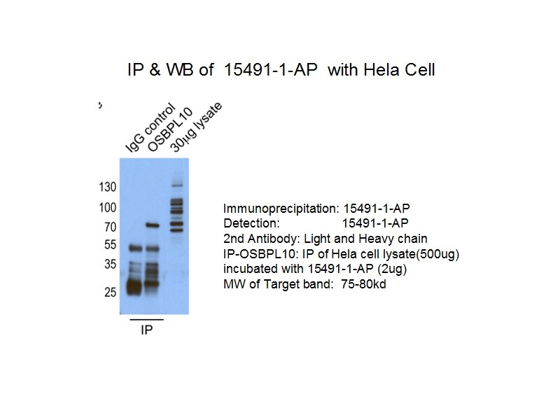 OSBPL10-Antibody-15491-1-AP-A253IP.jpg