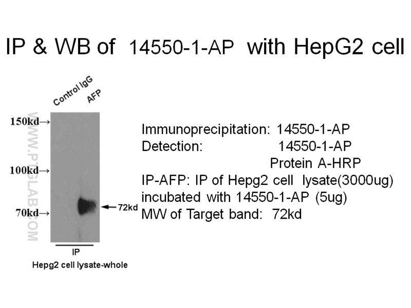 AFP-Antibody-14550-1-AP-A543IP.jpg