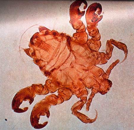 Phtirius%20pubis.jpg
