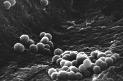 nanobacteria_2.jpg