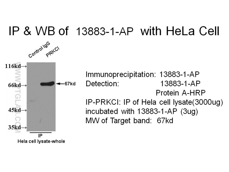 PRKCI-Antibody-13883-1-AP-A490IP.jpg