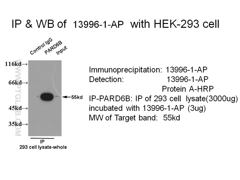 PARD6B-Antibody-13996-1-AP-A484IP.jpg