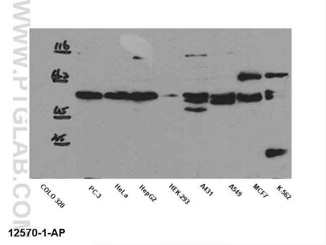 SMAD2-Antibody-12570-1-AP-A103WB.jpg