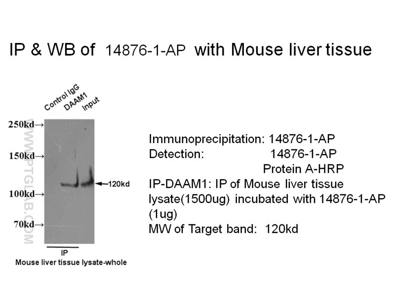 DAAM1-Antibody-14876-1-AP-IP-565.jpg