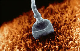 spermatozoide.jpg
