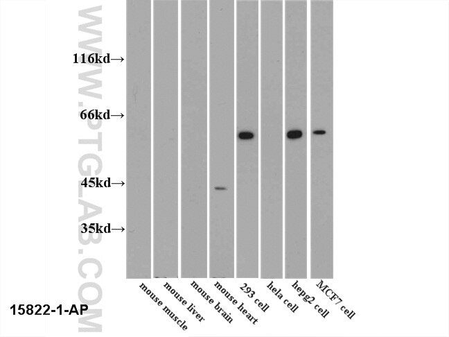 PKM2-specific-Antibody-15822-1-AP-A157WB.jpg